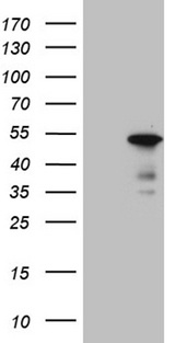 BHLHB2 / DEC1 Antibody - HEK293T cells were transfected with the pCMV6-ENTRY control. (Left lane) or pCMV6-ENTRY BHLHE40. (Right lane) cDNA for 48 hrs and lysed. Equivalent amounts of cell lysates. (5 ug per lane) were separated by SDS-PAGE and immunoblotted with anti-BHLHE40. (1:2000)