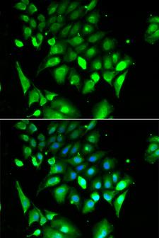 BHLHB2 / DEC1 Antibody - Immunofluorescence analysis of HeLa cells.