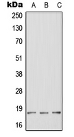 BHLHB40 / HES2 Antibody - Western blot analysis of HES2 expression in HeLa (A); mouse brain (B); rat brain (C) whole cell lysates.