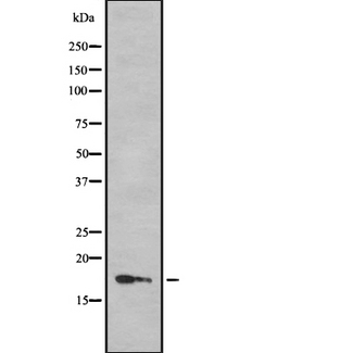 BHLHB40 / HES2 Antibody - Western blot analysis of HES2 using LOVO cells whole cells lysates