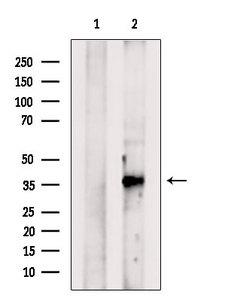 BHLHE22 / BHLHB5 Antibody