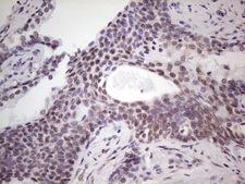 BHLHE41 / BHLHB3 / SHARP1 Antibody - Immunohistochemical staining of paraffin-embedded Human prostate tissue within the normal limits using anti-BHLHE41 mouse monoclonal antibody. (Heat-induced epitope retrieval by 1 mM EDTA in 10mM Tris, pH8.5, 120C for 3min,