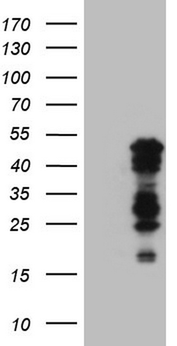 BHLHE41 / BHLHB3 / SHARP1 Antibody - HEK293T cells were transfected with the pCMV6-ENTRY control (Left lane) or pCMV6-ENTRY BHLHE41 (Right lane) cDNA for 48 hrs and lysed. Equivalent amounts of cell lysates (5 ug per lane) were separated by SDS-PAGE and immunoblotted with anti-BHLHE41.