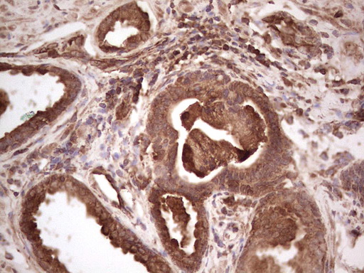 BHLHE41 / BHLHB3 / SHARP1 Antibody - Immunohistochemical staining of paraffin-embedded Human prostate tissue within the normal limits using anti-BHLHE41 mouse monoclonal antibody.  heat-induced epitope retrieval by 1 mM EDTA in 10mM Tris, pH8.5, 120C for 3min)