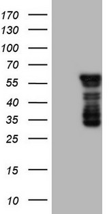 BHLHE41 / BHLHB3 / SHARP1 Antibody - HEK293T cells were transfected with the pCMV6-ENTRY control. (Left lane) or pCMV6-ENTRY BHLHE41. (Right lane) cDNA for 48 hrs and lysed. Equivalent amounts of cell lysates. (5 ug per lane) were separated by SDS-PAGE and immunoblotted with anti-BHLHE41.