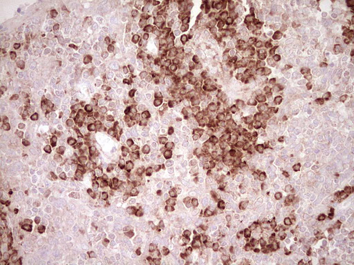 BHLHE41 / BHLHB3 / SHARP1 Antibody - Immunohistochemical staining of paraffin-embedded Human tonsil within the normal limits using anti-BHLHE41 mouse monoclonal antibody. (Heat-induced epitope retrieval by 1 mM EDTA in 10mM Tris, pH8.5, 120C for 3min,