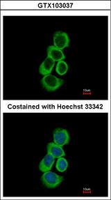 BHMT Antibody - Immunofluorescence of methanol-fixed A431 using BHMT antibody at 1:500 dilution.