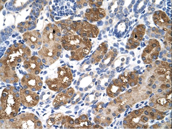BHMT Antibody - BHMT antibody BHMT(betaine-homocysteine methyltransferase) Antibody was used in IHC to stain formalin-fixed, paraffin-embedded human kidney.  This image was taken for the unconjugated form of this product. Other forms have not been tested.