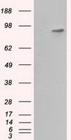 BHMT Antibody - HEK293T cells were transfected with the pCMV6-ENTRY control (Left lane) or pCMV6-ENTRY BHMT (Right lane) cDNA for 48 hrs and lysed. Equivalent amounts of cell lysates (5 ug per lane) were separated by SDS-PAGE and immunoblotted with anti-BHMT.