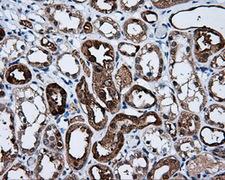 BHMT Antibody - Immunohistochemical staining of paraffin-embedded Kidney tissue using anti-BHMT mouse monoclonal antibody. (Dilution 1:50).
