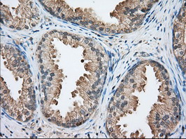 BHMT Antibody - IHC of paraffin-embedded Human prostate tissue using anti-BHMT mouse monoclonal antibody.