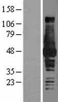 BHMT Protein - Western validation with an anti-DDK antibody * L: Control HEK293 lysate R: Over-expression lysate