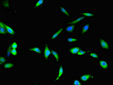 BHMT2 Antibody - Immunofluorescent analysis of Hela cells using BHMT2 Antibody at dilution of 1:100 and Alexa Fluor 488-congugated AffiniPure Goat Anti-Rabbit IgG(H+L)