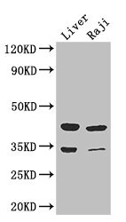 BHMT2 Antibody - Western Blot Positive WB detected in: Mouse liver tissue, Raji whole cell lysate All lanes: BHMT2 antibody at 3µg/ml Secondary Goat polyclonal to rabbit IgG at 1/50000 dilution Predicted band size: 41, 34 kDa Observed band size: 41, 34 kDa