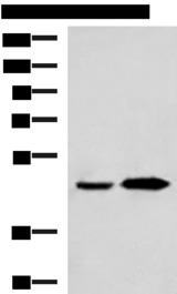 BHMT2 Antibody - Western blot analysis of Human fetal liver tissue and Human liver tissue lysates  using BHMT2 Polyclonal Antibody at dilution of 1:800