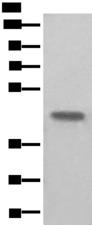 BHMT2 Antibody - Western blot analysis of Human kidney tissue lysate  using BHMT2 Polyclonal Antibody at dilution of 1:450