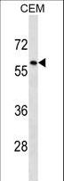 BIA2 / TRIM58 Antibody - TRIM58 Antibody western blot of CEM cell line lysates (35 ug/lane). The TRIM58 antibody detected the TRIM58 protein (arrow).