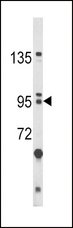 BICC1 Antibody - Western blot of BICC1 Antibody in HL-60 cell line lysates (35 ug/lane). BICC1 (arrow) was detected using the purified antibody.
