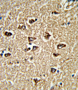 BICC1 Antibody - Formalin-fixed and paraffin-embedded human brain tissue reacted with BICC1 Antibody , which was peroxidase-conjugated to the secondary antibody, followed by DAB staining. This data demonstrates the use of this antibody for immunohistochemistry; clinical relevance has not been evaluated.