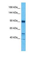 BICC1 Antibody - Western blot of BICC1 Antibody with human MCF7 Whole Cell lysate.  This image was taken for the unconjugated form of this product. Other forms have not been tested.
