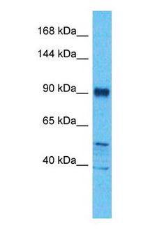 BICC1 Antibody - Western blot of BICC1 Antibody with human MCF7 Whole Cell lysate.  This image was taken for the unconjugated form of this product. Other forms have not been tested.