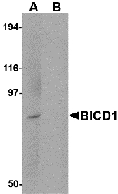 BICD1 Antibody - Western blot of BICD1 in Daudi cell lysate with BICD1 antibody at 1 ug/ml in (A) the absence and (B) the presence of blocking peptide.