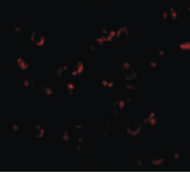 BICD1 Antibody - Immunofluorescence of BICD1 in Daudi cells with BICD1 antibody at 20 ug/ml.