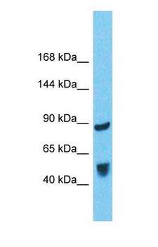 BICD1 Antibody - Western blot of BICD1 Antibody with human Fetal Liver lysate.  This image was taken for the unconjugated form of this product. Other forms have not been tested.