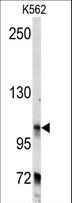 BICD2 Antibody - Western blot of anti-BICD2 Antibody in K562 cell line lysates (35 ug/lane). BICD2(arrow) was detected using the purified antibody.