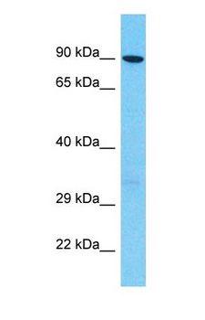 BICD2 Antibody - Western blot of BICD2 Antibody with human 721_B Whole Cell lysate.  This image was taken for the unconjugated form of this product. Other forms have not been tested.