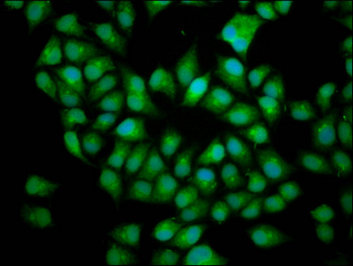 BICD2 Antibody - Immunofluorescence staining of Hela cells diluted at 1:166, counter-stained with DAPI. The cells were fixed in 4% formaldehyde, permeabilized using 0.2% Triton X-100 and blocked in 10% normal Goat Serum. The cells were then incubated with the antibody overnight at 4°C.The Secondary antibody was Alexa Fluor 488-congugated AffiniPure Goat Anti-Rabbit IgG (H+L).