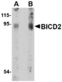 BICD2 Antibody - Western blot of BICD2 in A549 cell lysate with BICD2 antibody at (A) 1 and (B) 2 ug/ml.