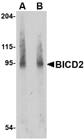 BICD2 Antibody - Western blot of BICD2 in A549 cell lysate with BICD2 antibody at (A) 1 and (B) 2 ug/ml.