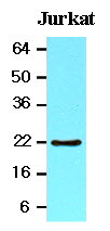 BID Antibody - The lysates of Jurkat (20 ug) were resolved by SDS-PAGE, transferred to NC membrane and probed with anti-human BID (1:1000). Proteins were visualized using a goat anti-mouse secondary antibody conjugated to HRP and an ECL detection system.