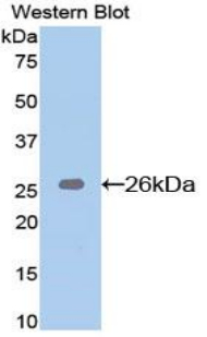 BID Antibody - Western blot of recombinant BID.  This image was taken for the unconjugated form of this product. Other forms have not been tested.