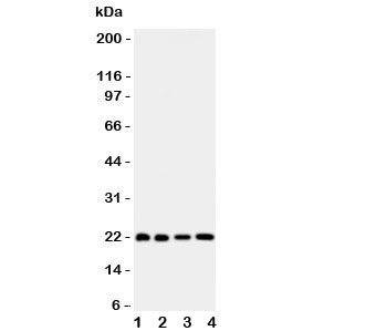 BID Antibody - Western blot testing of Bid antibody and Lane 1: HeLa; 2: COLO320; 3: Jurkat; 4: SKOV lysate. Expected/observed size ~22KD