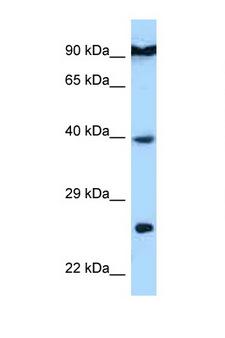 BID Antibody - BID antibody Western blot of HepG2 Cell lysate. Antibody concentration 1 ug/ml.  This image was taken for the unconjugated form of this product. Other forms have not been tested.