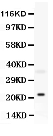 BID Antibody - Anti-Bid antibody, Western blotting All lanes: Anti Bid at 0.5ug/mlWB: Mouse Brain Tissue Lysate at 50ugPredicted bind size: 22KD Observed bind size: 22KD