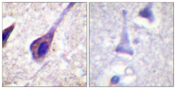 BID Antibody - Immunohistochemistry analysis of paraffin-embedded human brain, using BID Antibody. The picture on the right is blocked with the synthesized peptide.