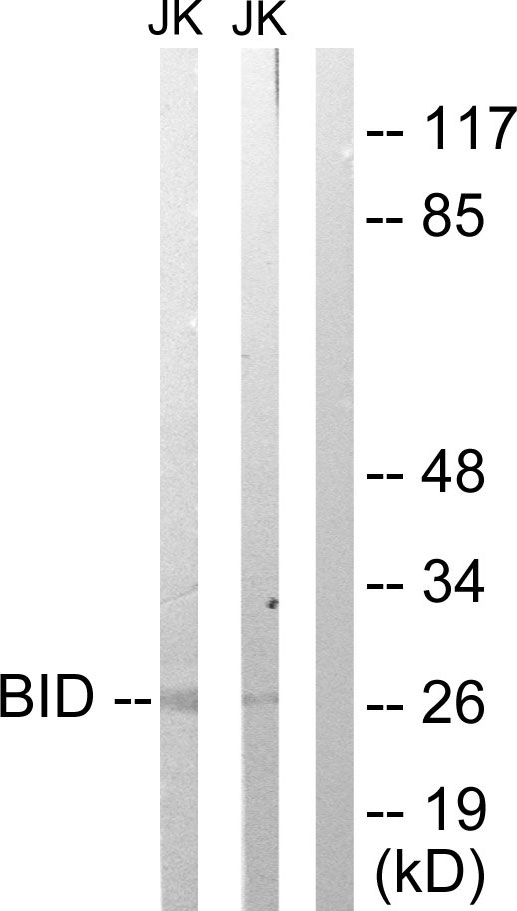 BID Antibody - Western blot analysis of lysates from Jurkat cells treated with H2O2 100uM 30', using BID Antibody. The lane on the right is blocked with the synthesized peptide.