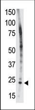 BID Antibody - The anti-Bid BH3 domain antibody is used in Western blot to detect Bid BH3 in HL-60 cell lysate.