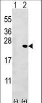 BID Antibody - Western blot of Bid (arrow) using rabbit polyclonal Bid Antibody (BH3). 293 cell lysates (2 ug/lane) either nontransfected (Lane 1) or transiently transfected (Lane 2) with the Bid gene.