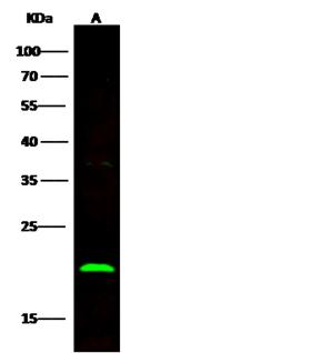 BID Antibody - Anti-BID rabbit monoclonal antibody at 1:500 dilution. Lane A: Jurkat Whole Cell Lysate. Lysates/proteins at 30 ug per lane. Secondary: Goat Anti-Rabbit IgG H&L (Dylight800) at 1/10000 dilution. Developed using the Odyssey technique. Performed under reducing conditions. Predicted band size: 22 kDa. Observed band size: 22 kDa.