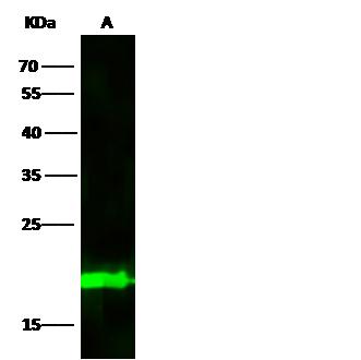 BID Antibody - Anti-BID mouse monoclonal antibody at 1:500 dilution. Lane A: Jurkat Whole Cell Lysate. Lysates/proteins at 30 ug per lane. Secondary: Goat Anti-Mouse IgG H&L (Dylight800) at 1/15000 dilution. Developed using the Odyssey technique. Performed under reducing conditions. Predicted band size: 22 kDa. Observed band size: 22 kDa.