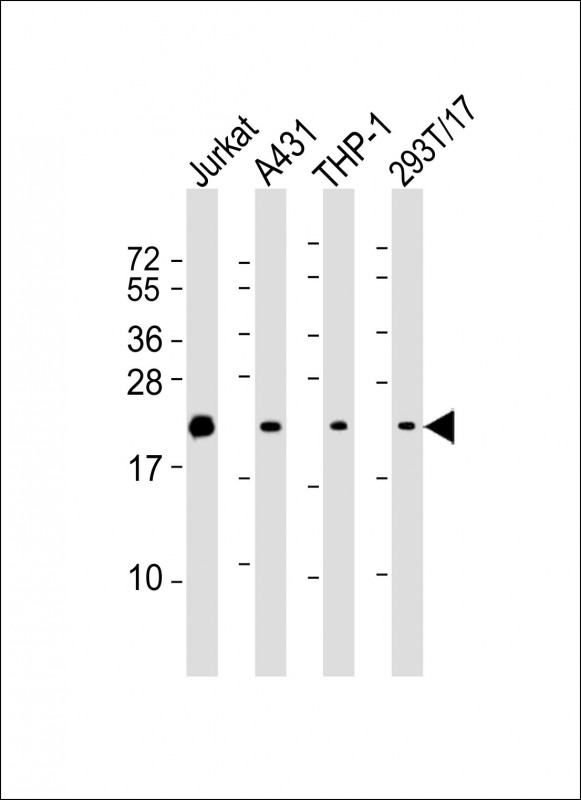 BID Antibody - All lanes: Anti-BID Antibody at 1:4000 dilution. Lane 1: Jurkat whole cell lysates. Lane 2: A431 whole cell lysates. Lane 3: THP-1 whole cell lysates. Lane 4: 293T/17 whole cell lysates Lysates/proteins at 20 ug per lane. Secondary Goat Anti-mouse IgG, (H+L), Peroxidase conjugated at 1:10000 dilution. Predicted band size: 22 kDa. Blocking/Dilution buffer: 5% NFDM/TBST.