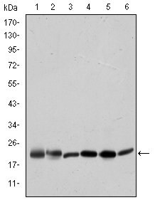 BID Antibody - Western blot using BID mouse monoclonal antibody against HeLa (1), A431 (2), Jurkat (3), A549 (4), HepG2 (5), and HEK293 (6) cell lysate.