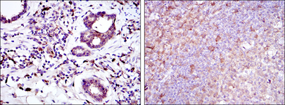 BID Antibody - IHC of paraffin-embedded prostate tissues (left) and tonsil tissues (right) using BID mouse monoclonal antibody with DAB staining.