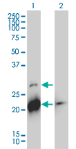 BID Antibody - Western Blot analysis of BID expression in transfected 293T cell line by BID monoclonal antibody (M01), clone 3F3-1A3.Lane 1: BID transfected lysate(22 KDa).Lane 2: Non-transfected lysate.
