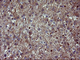 BID Antibody - IHC of paraffin-embedded Human liver tissue using anti-BID mouse monoclonal antibody. (Heat-induced epitope retrieval by 10mM citric buffer, pH6.0, 120°C for 3min).