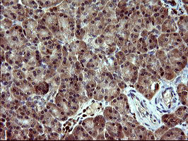 BID Antibody - IHC of paraffin-embedded Human pancreas tissue using anti-BID mouse monoclonal antibody. (Heat-induced epitope retrieval by 10mM citric buffer, pH6.0, 120°C for 3min).